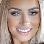 Social media influencer showing teeth whitening results at The White Smile Company Christchurch