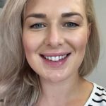 Client smile reveal after professional teeth whitening Christchurch NZ