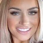Social media influencer showing teeth whitening results at The White Smile Company Christchurch