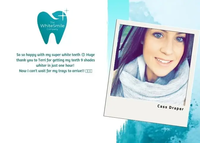 Customer review and testimonial - The White Smile Company Christchurch