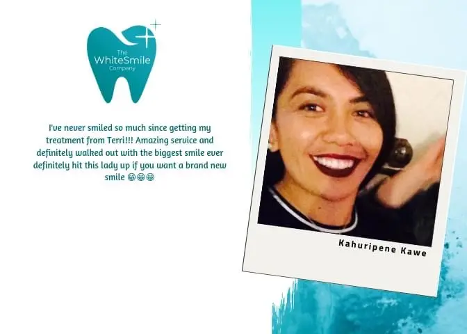 Five star customer review with photo - The White Smile Company Christchurch teeth whitening