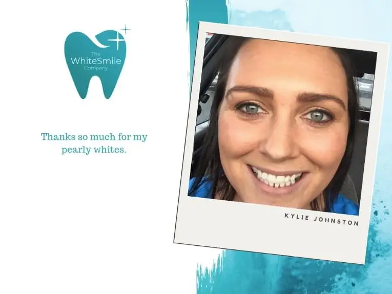Five star rated teeth whitening review - White Smile Company Christchurch
