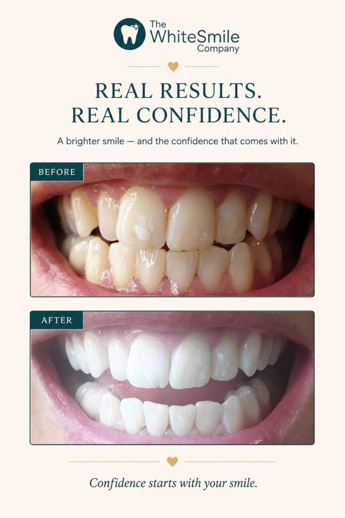 Teeth whitening Christchurch before and after — a dramatically whiter smile at The White Smile Company