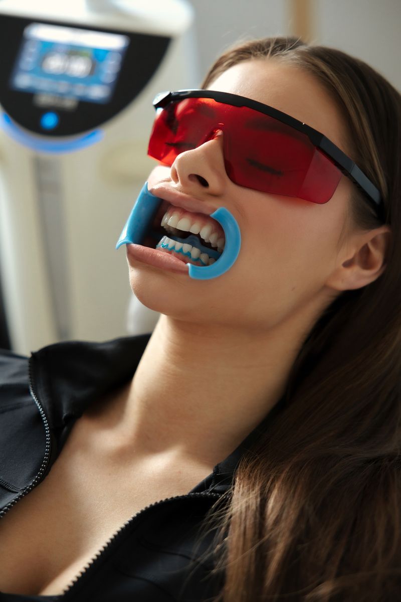 Laser teeth whitening in progress at The White Smile Company, Christchurch