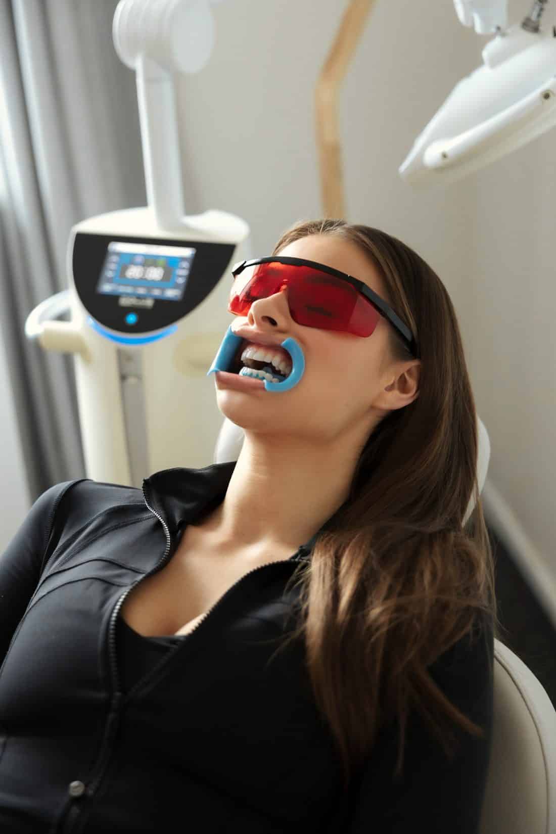 Laser teeth whitening in progress at The White Smile Company, Christchurch